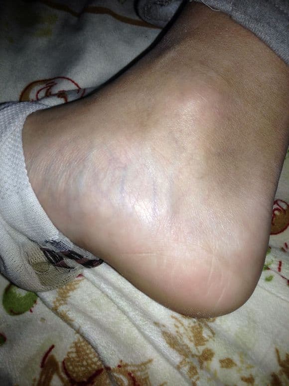 Wife's stinky cotton socks feet, take them off!!!