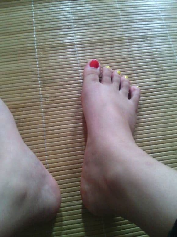 Close-up of adult feet showing natural texture and slight wear, toes relaxed on a soft rug under natural window light