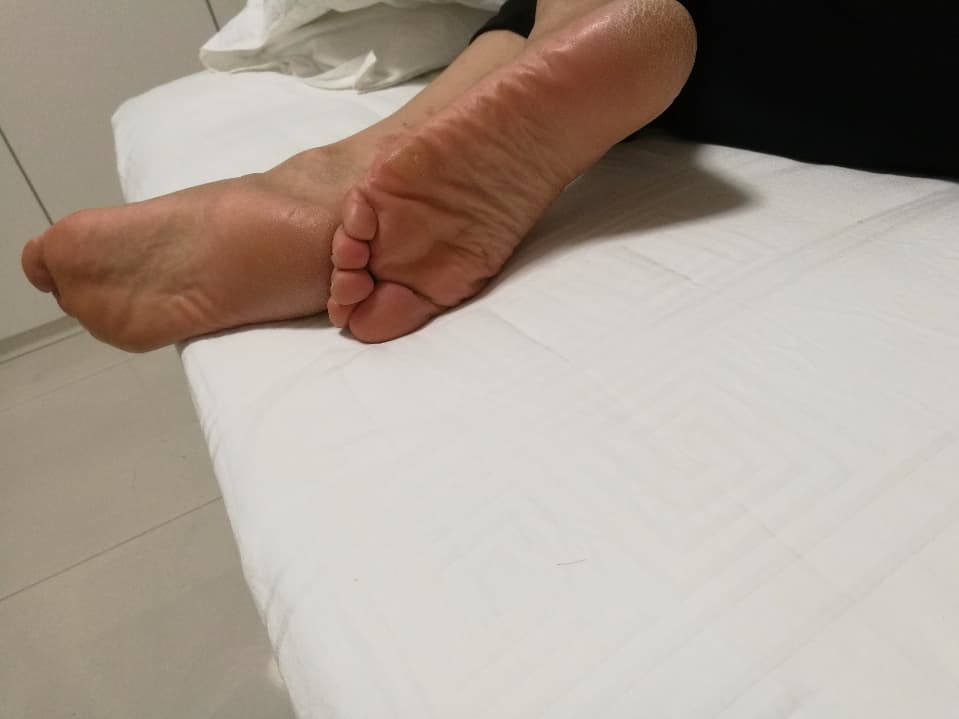 Close macro of heel and arch showing soft calluses and natural skin texture