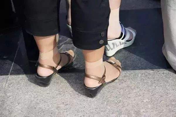 Bare foot on sunlit curb