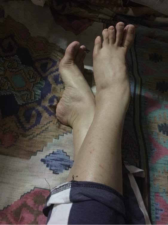 Stockings smoothed over an exposed ankle