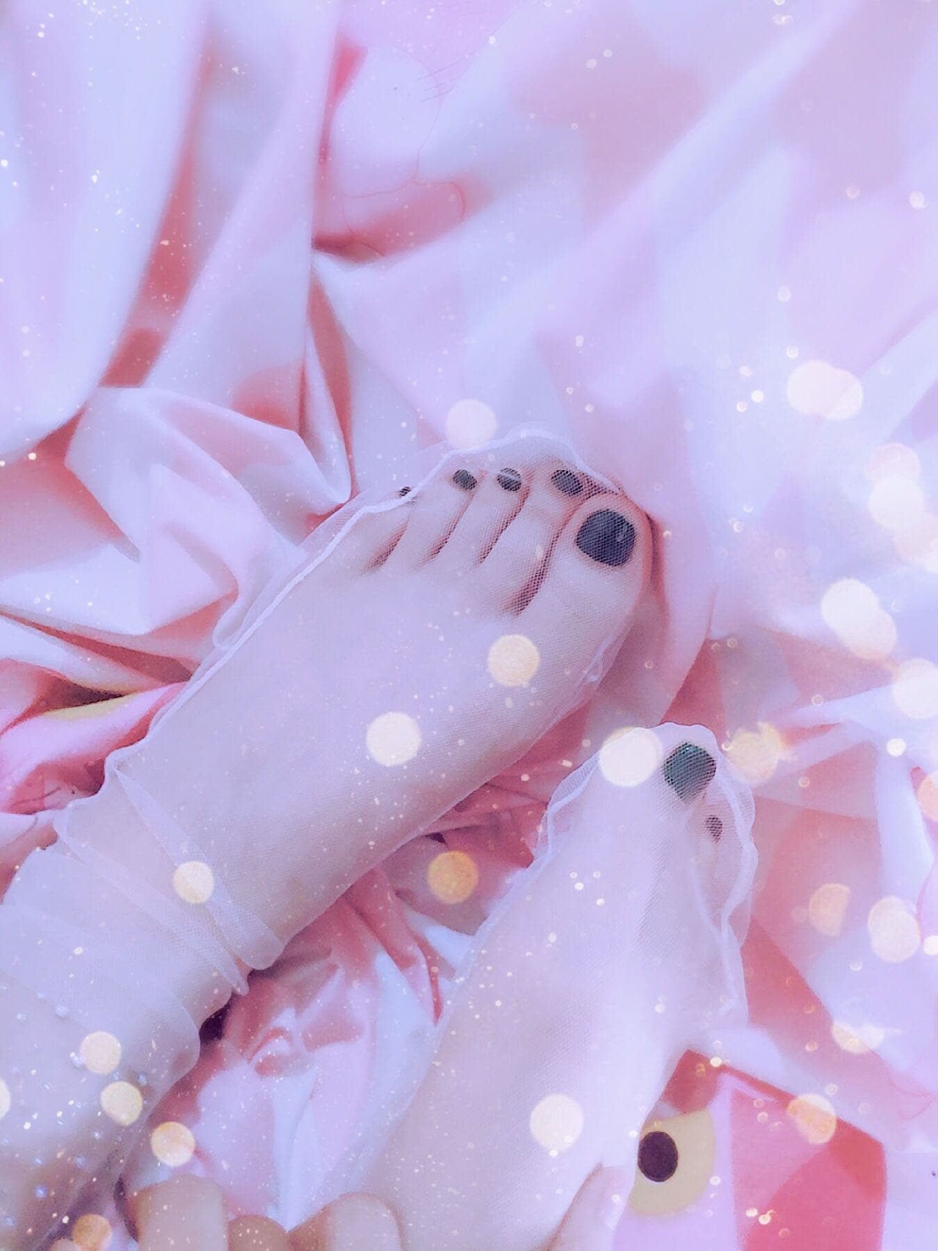 Close-up of stockinged foot with slight redness on the arch, showing sensitive skin and stretched nylon fabric