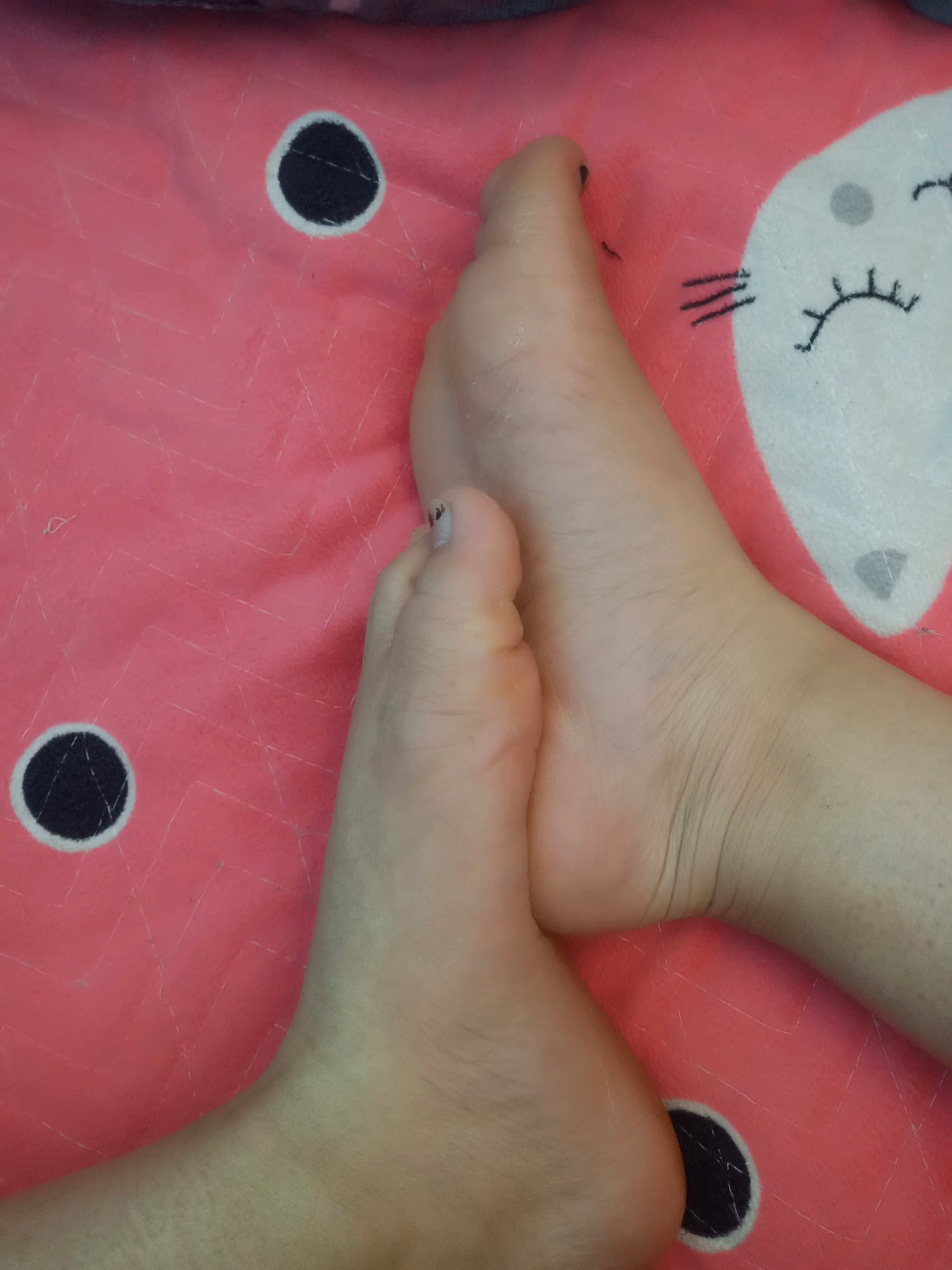 Stocking cuff on full thigh