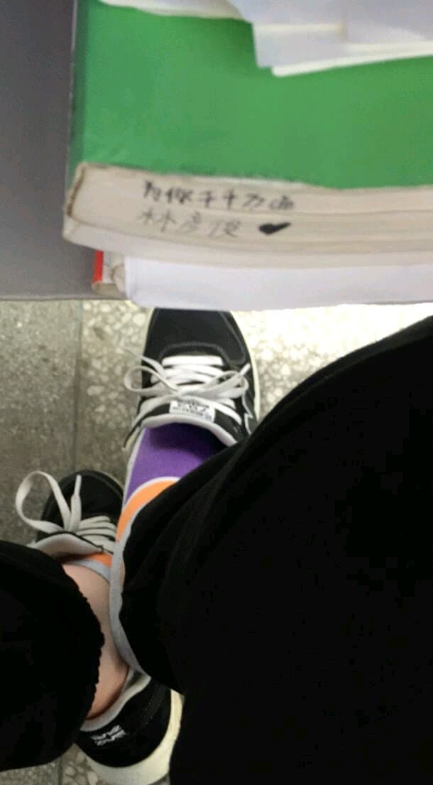 worn cotton sock on imperfect foot